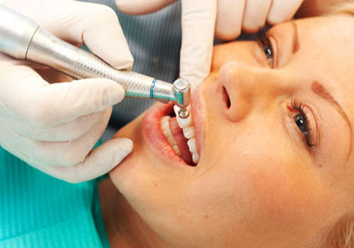 Diş Taşı Temizliği Fiyatı, Diş Taşı Tartar Neden Olur?